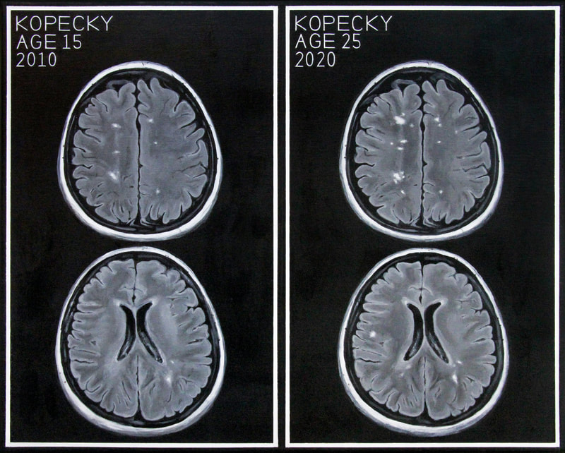 May Kopecky Self-Portrait #10yearchallenge by May Ling Kopecky acrylic painting MRI scan brain