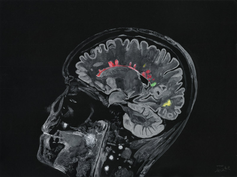 May Kopecky Self Portrait MRI by May Ling Kopecky Gouache and Watercolor painting